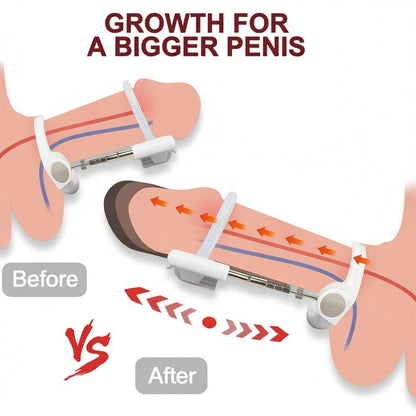 ExtenderPro product image 3
